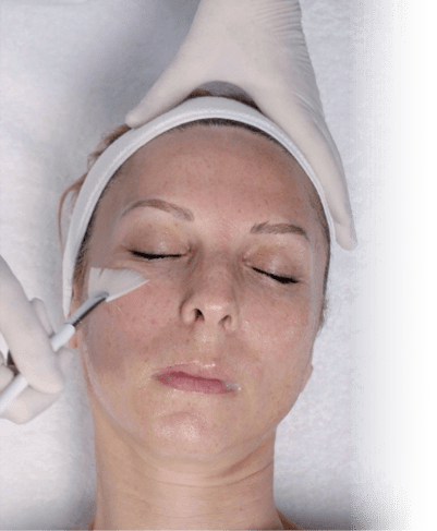 Peeling Eneomey Application Prepeel